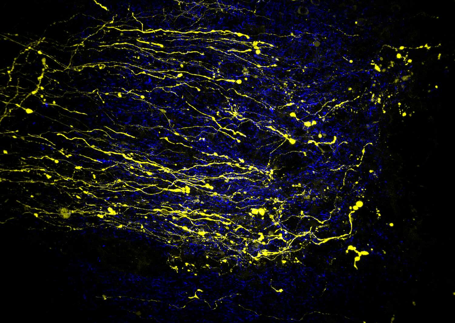 Fluorescent microscope image showing thin, branching yellow neural fibers against a dark background with scattered blue signals, resembling nerve cells or neural networks.
